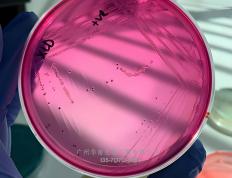 丹麦ssi中(zhōng)国官網(wǎng)中(zhōng)文版