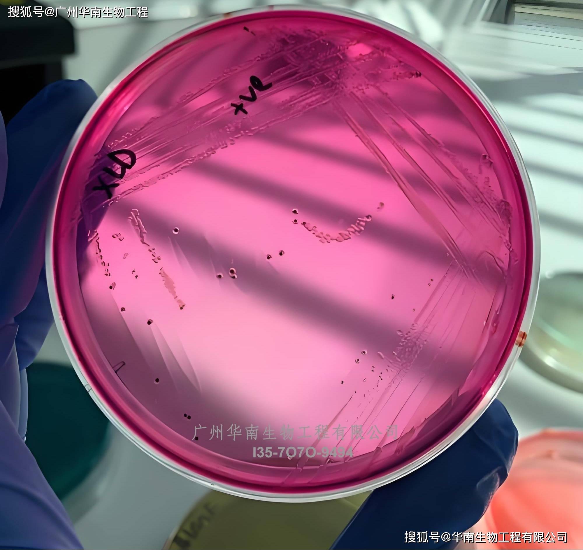 丹麦ssi中(zhōng)国官網(wǎng)中(zhōng)文版